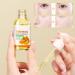 Turmeric Serum Dark Spots 30 ml Spot Corrector Face & Body Anti Aging and Wrinkle Face Serum Reduces Hyperpigtation Age Spots Sun Spot Improve Skin Tone Moisturize Brighten All Types - Buy Online on SooperMarket.com