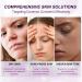 Marianp Hyaluronic Acid Serum & Azelaic Acid 10% for Acne Pigmentation & Rosacea - Vitamin B3 & B5 | Best Skincare Treatment - Buy Online on SooperMarket.com