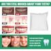 Temporary Teeth Repair Kit - Moldable Thermal False Teeth Fitting Beads - 50g - Buy Online on SooperMarket.com