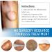 Lipoma Removal Cream 20g - Natural Treatment for Lipoma Care & Discomfort - Buy Online on SooperMarket.com