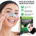 Nose Strips 20 Pcs for Blackheads - Deep Cleansing Pore Strips for Men & Women - Blackhead Remover - Buy Online on SooperMarket.com