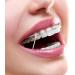 500pc Annhua Dental Orthodontic Rubber Bands | Teeth Gap & Crooked Teeth Braces | Monkey 4.5oz 3/8 - Buy Online on SooperMarket.com