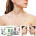 Herbal Anti-Itch Cream for Psoriasis, Dermatitis, Eczema - Multicolor, One Size - Buy Online on SooperMarket.com