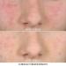 Biossance Squalane + Probiotic Gel Moisturizer - Gentle Formula for Calming Redness, Rosacea, and Pores - 1.6 oz - Buy Online on SooperMarket.com