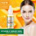 Shefave Vitamin C Serum for Face - Dark Spot Remover - Face Serum with 30x Vitamin C and Hyaluronic Acid - Anti-Dark Spot Serum - Fading Dark Spots for Tired Pale Skin - Buy Online on SooperMarket.com