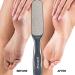 Probelle Double Sided Multidirectional Nickel Foot File Callus Remover - Instantly Reduce Calluses and Corns to Powder, Safe Tool (Dark Grey) - Buy Online on SooperMarket.com