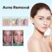CRusio Awzlove Ampoule Scar Removal Serum - Remove New Scars in 3 Weeks, Old Scars in 6 Weeks (1pcs) - Buy Online on SooperMarket.com