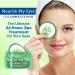 Fran Wilson Nourish My Eyes Cucumber and Green Tea Pads - 36 Pads | At-Home Spa Treatment for Puffiness | Revitalize Your Eyes | Easy-to-Use Eye Pads for Dark Circles (Pack of 3) - Buy Online on SooperMarket.com