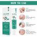 Nail Repair Cream Effective Fungal Nail Treatment for Toenails Fungus Nail Cream Nourishing For Restores Discolored & Damaged Strong Nail Fungus Treatment for Toenail Restores Healthy Appearance - Buy Online on SooperMarket.com