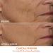 Dr. Dennis Gross DRx SpectraLite DPL FaceWare Pro - Smooths Fine Lines, Firms Skin, Prevents Acne, Reduces Redness (White) - Buy Online on SooperMarket.com