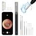 Ear Wax Removal Wireless 1296P HD Ear Wax Removal Tool with Camera 6 LED Lights Built-in WiFi Waterproof Otoscope for iPhone Android Black