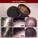 Jitesy Laser Therapy Cap - 236 Probes Red-Blue-Light Hair Growth System for Thinning Hair & Androgenetic Alopecia Treatment - Fast International Shipping - Buy Online on SooperMarket.com