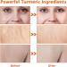 Turmeric Soap Bar Handmade Tumeric Soap Organic Turmeric Brightening Soap for All Skin Types Natural Soap for Cleansing Unclogs Pores Deep Cleaning - Buy Online on SooperMarket.com