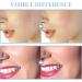 Portable High Frequency Facial Machine with 4 Tubes | TUMAKOU Skin Wand - Buy Online on SooperMarket.com