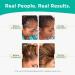 Minoxidil 2% Women's Hair Growth Serum | Promotes Hair Regrowth | Reactivates Hair Follicles | Shapiro MD - Buy Online on SooperMarket.com