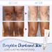 SnowySkin Legs Underarm Cream & Nose Strips Set - Instant Personal Skin Care | White | One Size - Buy Online on SooperMarket.com