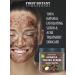 Organic Arabica Coffee Scrub with Coconut and Shea Butter - Acne & Cellulite Treatment, Varicose Vein Therapy - 10 oz - Buy Online on SooperMarket.com