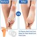 12 Sheet Callus Cushion Soft Felt Callus Pads Men Women Soreness Relief Soft Adhesive Round Foot Corn Callus Pad Remover Stick Foot Care Cushions for Men Women - Buy Online on SooperMarket.com