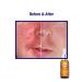 iS CLINICAL Pro-Heal Serum Advance+ 0.5 Fl Oz Yellow - Pack of 1 - Buy Online on SooperMarket.com