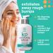 12% Glycolic Acid Body Lotion for Keratosis Pilaris | Exfoliating Moisturizer for Rough & Bumpy Skin | Redness Reduction | 8 oz - Buy Online on SooperMarket.com