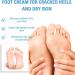 Foot Cream For Very Dry Feet Natural Foot Cream Foot Cream For Calluses And Hard Skin Cracked Heel Repair Balm Coconut Oil Foot Moisturiser Callus Remover Soften For Feet Knees Hand - 50g - Buy Online on SooperMarket.com
