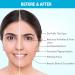 Buy Nykaa Naturals Facial Ice Globes for Puffiness & Wrinkles - Tighten Skin & Reduce Dark Spots - International Shipping Available - Buy Online on SooperMarket.com