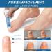 Extra Strength Toenail Fungus Treatment Cream for Thick, Broken, Discolored Nails - 1 Count - Buy Online on SooperMarket.com