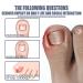 German Toenailcare Removal Paronychia Oil - Repair Damaged Discolored Thick Nails - 2 Pcs - Buy Online on SooperMarket.com