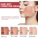 Dark Spot Correcting Serum Peach 70% Niacinamide Serum for Acne Scars Post-Acne Marks Korean Skincare Set for Teenagers Adult - Buy Online on SooperMarket.com