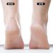 Nado Care 4 Pairs Heels Moisturizing Socks for Dry Cracked Heels Repair - Gel Heel Sleeves - Open Toe Comfy Socks - Pink Blue Grey Black - Buy Online on SooperMarket.com