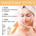 Glycolic Acid 7% Exfoliating Toner 7% Glycolic Acid Toner for Acne Prone Skin Glycolic Acid 7% Toning Solution for Blemishes and Acne Face Toner for Oily Skin Hydrating Toner Minimises Pores - Buy Online on SooperMarket.com