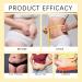 Bee Venom Slimming Oil Bee Venom Drops Bee Venom Intestinal Detox Belly Button Drops Bee Venom Belly Button Drops Bee Venom Oil Bee Venom Lymphatic Drainage Oil Tightening & Shaping Curve Body 2 - Buy Online on SooperMarket.com