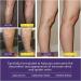 Varicose Vein & Spider Vein Cream | Capillary Health Treatment | Improve Circulation 0.7oz - Buy Online on SooperMarket.com