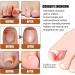 Ingrown Toenail Treatment and Removal Relief Oil - Nail Growth and Fungal Corrector - Buy Online on SooperMarket.com