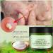 Acne Cream Moisturiser Face Cream Spot Cream Mens Moisturiser Tea Tree Cream Spot Cream For Acne Cream Moisturiser for Women Men Teenagers Dilute Face Prone Spot Marks Balance Facial Oil Cream - Buy Online on SooperMarket.com