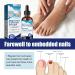 Ingrown Toenail Treatment - 30ML Ingrown Toenail Correction Drops - Nail Helper Ingrowth Toenail Treatment Oil - Trimming Toenail Softening Drops - Nail Fungal Treatment - Buy Online on SooperMarket.com