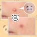 AUSLKA Panda Pimple Patches 120 Count - Hydrocolloid Spot Dots for Face Acne Absorbing Cover Patch - Blemishes and Pimple Stickers for Clear Skin - Pack of 1 - Buy Online on SooperMarket.com