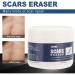 Scar Gel - Skin Repair and Removal Treatment for Face, Body, Surgery, Burns, Stretch Marks - Buy Online on SooperMarket.com