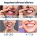 VEROA Tooth Gum Pain Relief Spray - Real Time Toothache Gum Pain Relief for Adult Relieve Gum Swelling Natural Toothache Relief Strong Mouth Spray - for Gum Disease Treatment for Adults - 20ML - Buy Online on SooperMarket.com