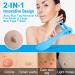Painless 2-in-1 Skin Tag Removal Kit for Micro to Large Skin Tags (1-9mm) - Safe & Easy DIY Tool for Home Use - Buy Online on SooperMarket.com