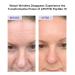 Peptide 11 Botulinum Tension Up Repair Cream 50ml | Anti-Aging Skincare | International Shipping Available - Buy Online on SooperMarket.com