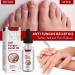 TBeautfave Fungal Nail Treatment Antifungal Nail Treatment Toe Nail Fungal Treatment Fungal Nail Treatment for Toenails Extra Strong Nail Repair and Strengthen Fix & Renew Damaged Broken Nails - Buy Online on SooperMarket.com