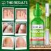NAIL LAB Premium Fungal Nail Treatment 50ml - Tea Tree Oil for Toenails & Fingernails - Includes Bonus Nail Fungal Pen & File - Buy Online on SooperMarket.com