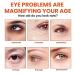 Propolis Moisture Firming Eye Cream - Anti-Wrinkle Hydrating Anti-Aging Renewal for Bags & Lifting (1PC) - Ships Internationally - Buy Online on SooperMarket.com