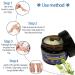 Varicose Veins Cream & Spider Veins Repair - Improve Blood Circulation & Soothe Itching - 1.76 OZ - Buy Online on SooperMarket.com