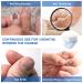 Nail Fungus Treatment Kit - Laser Device for Onychomycosis & Ingrown Toenail - Improves Nail Health with Blue Light - Buy Online on SooperMarket.com