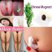 Mugwort Belly Button Patch (60PCS) - Natural Plant for Men and Women - White - Buy Online on SooperMarket.com