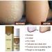 2 Pcs Athlete's Foot Spray Set - Foot Peeling & Odor Eliminator (60ml) | For Women & Men - Buy Online on SooperMarket.com