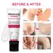 Venanoci Dark Spot Corrector Cream: Instant Results for Armpit, Knees, Elbows, & Private Areas - with Hyaluronic Acid & Mulberry Extract - Buy Online on SooperMarket.com
