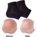 Vented Moisturizing Gel Heel Socks 3 Pairs Toeless Spa Sock for Foot Care Treatment Cracked Heels Dry Feet Foot Calluses (Black) - Buy Online on SooperMarket.com